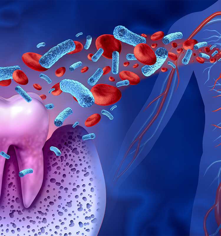 歯周病と全身の健康のつながり